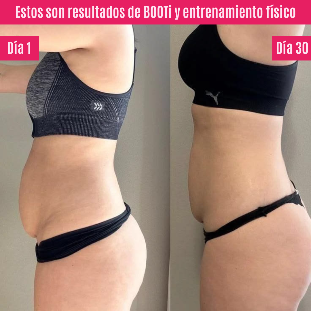 BOOTi™ | Suplemento para glúteos, celulitis, piel flácida y grasa localizada