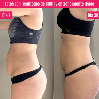 BOOTi™ | Suplemento para glúteos, celulitis, piel flácida y grasa localizada